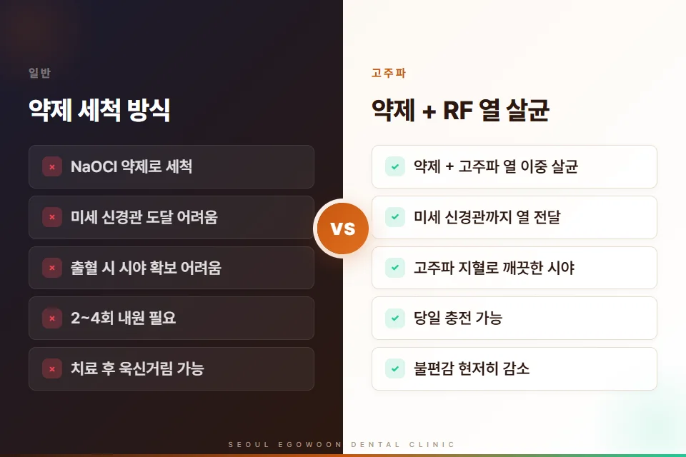 고주파 신경치료 일반 신경치료 비교