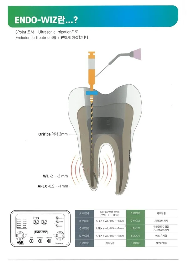 엔도위즈 ENDO-WIZ 고주파 신경치료 원리 치아 단면도