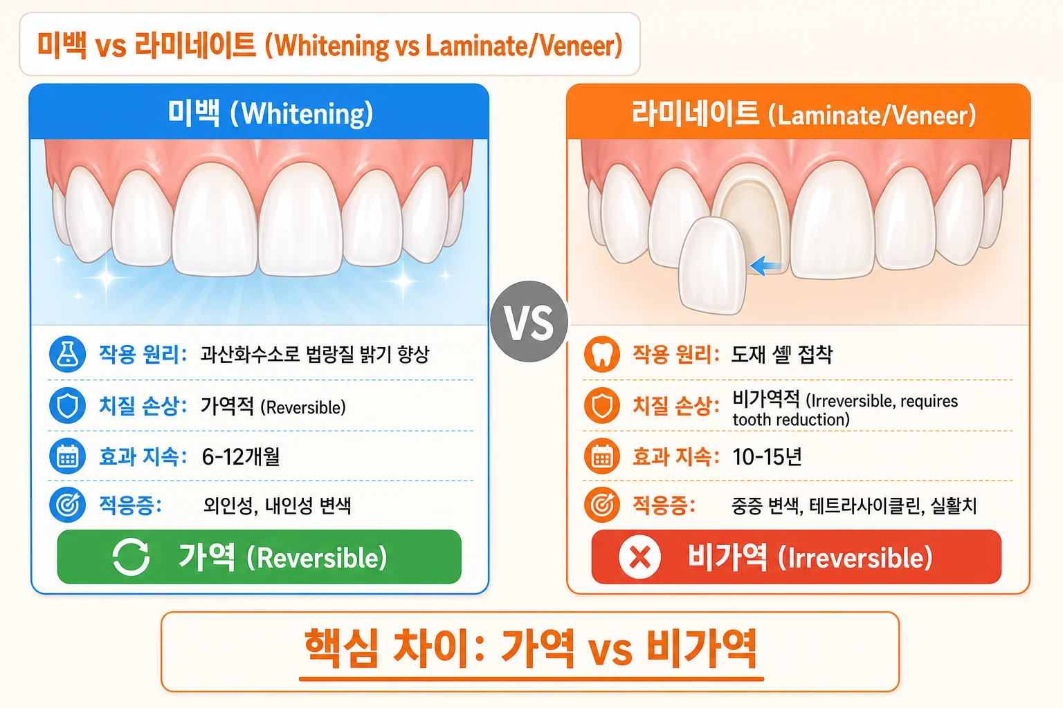 미백 라미네이트 비교 — 작용 원리, 치질 손상, 효과 지속, 적응증 차이를 보여주는 비교 카드