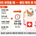 잇몸이 부었을 때 응급처치, 안전한 자가 처치와 응급실 신호 | 파주 서울이고운치과 잇몸이 부었을 때 진단 흐름도, 4가지 원인과 자가 케어·응급실 분기 인포그래픽