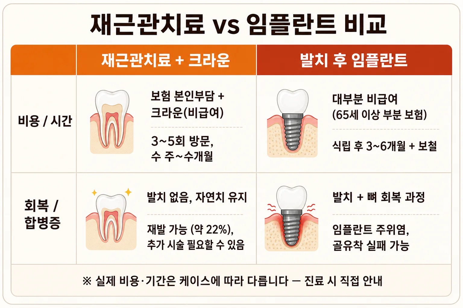 재근관치료 + 크라운 vs 발치 후 임플란트 비용·시간·회복·재실패 4분면 비교 인포그래픽