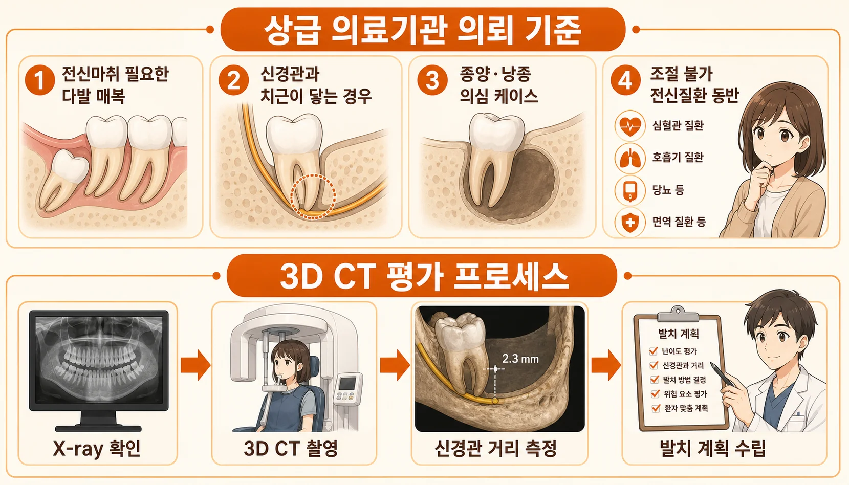 사랑니 발치 상급 의료기관 의뢰 기준 4가지와 사전 CT 평가 과정 인포그래픽