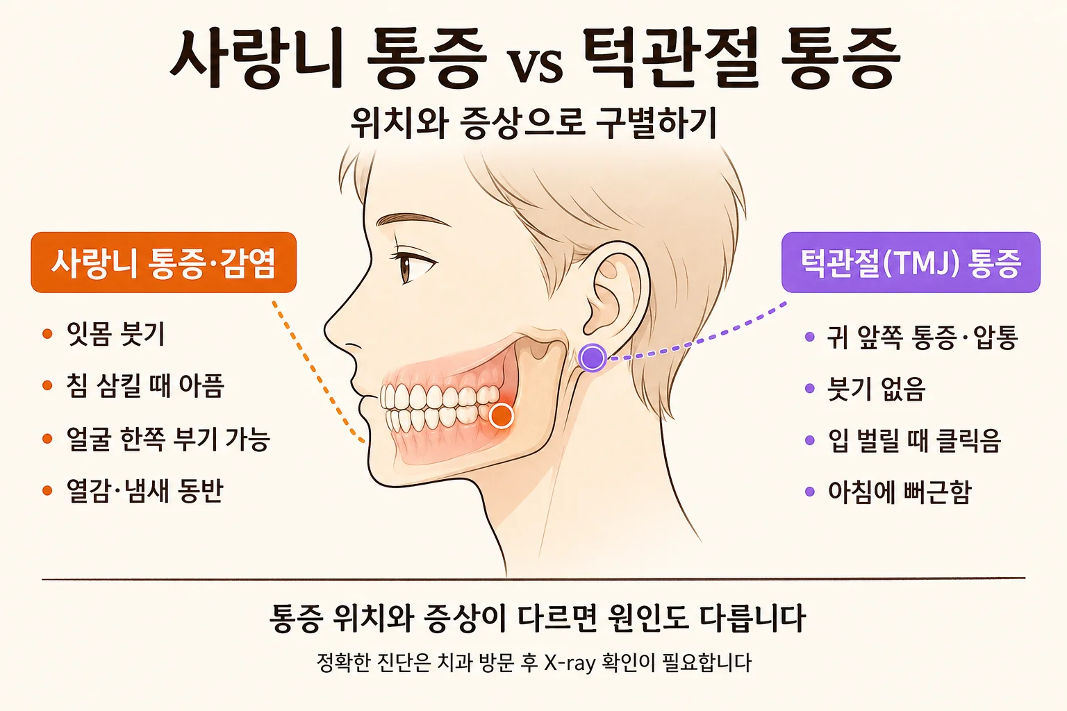 사랑니 통증 원인 | 사랑니 감염 vs 턱관절 통증 감별 인포그래픽